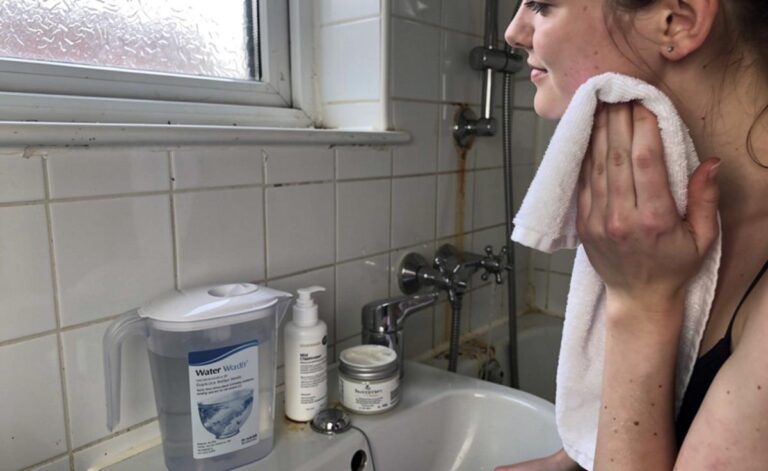 Hard Water Skincare: Solutions for Sensitive UK Skin